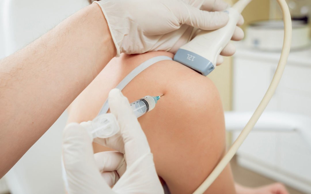 Kas İçi Prp Enjeksiyonu | WWW İstanbul