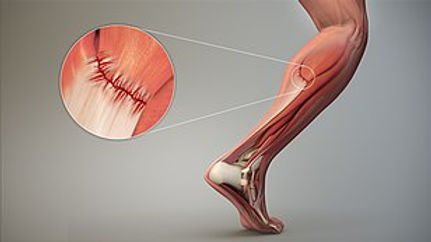 Kas Yırtılması Prp Fiyatı | WWW İstanbul